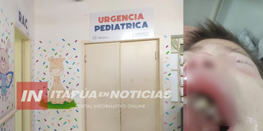 NIÑO DE 8 AÑOS LLEGÓ CON LA BOCA AGUSANADA AL HOSPITAL REGIONAL DE