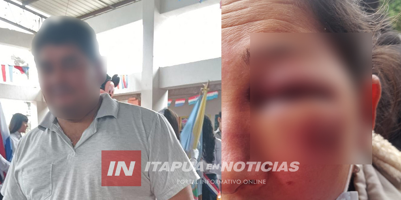 HOMBRE HABRÍA GOLPEADO BRUTALMENTE A SU PAREJA EN CAMBYRETÁ