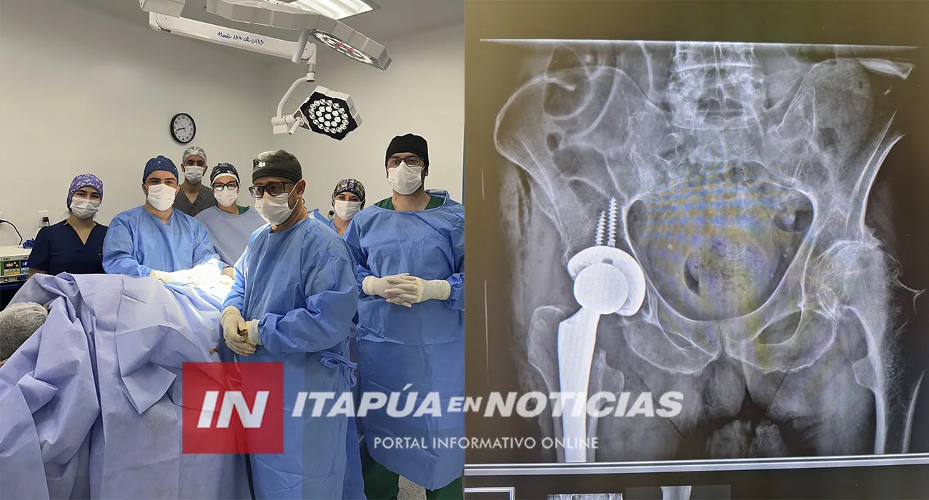 HOSPITAL GENERAL DE ITAPÚA REALIZA CON ÉXITO CIRUGÍA DE CADERA