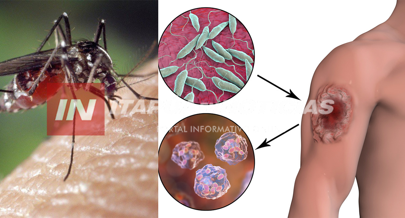 LA VII REGIÓN SANITARIA REFUERZA LA VIGILANCIA CONTRA LA LEISHMANIASIS