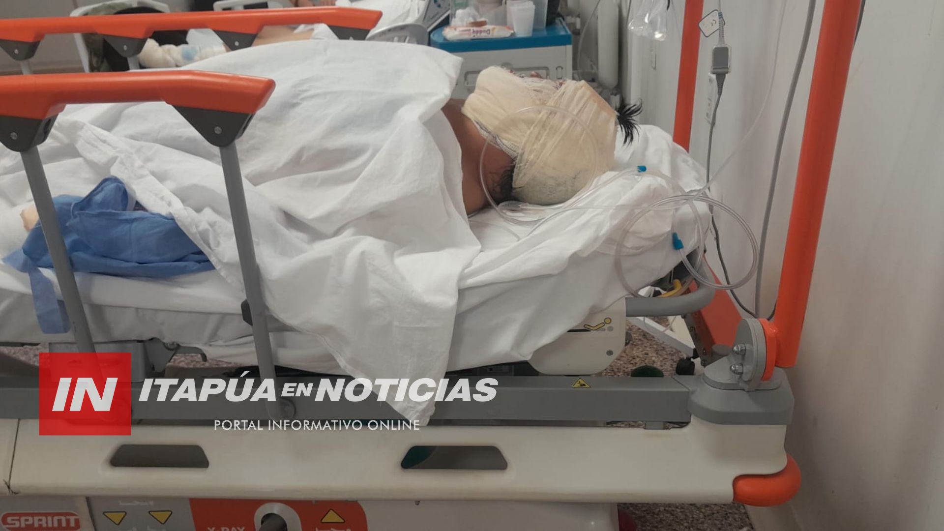 MUJER PERMANECE INTERNADA TRAS SUFRIR QUEMADURAS EN EL ROSTRO Y SE ENCUENTRA FUERA DE PELIGRO MUJER PERMANECE INTERNADA TRAS SUFRIR QUEMADURAS EN EL ROSTRO Y SE ENCUENTRA FUERA DE PELIGRO